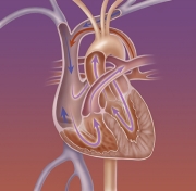 AbBloodflow360