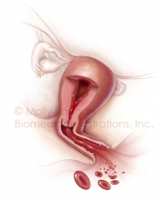 Heavy-menstruation-copyright