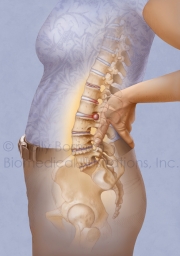Low-back-pain-NEW
