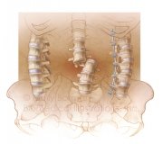 Lumbar-trauma-copyright