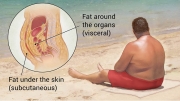 Obesity-mbp-V3