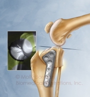 Canine-stifle-TPLO-copyright