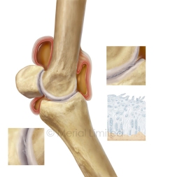 Equine-fetlock-oa-copyright-merial